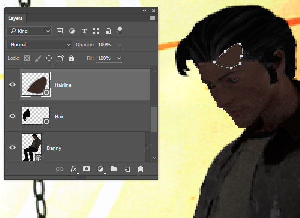 Add the receeding hairline