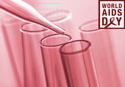 Cómo hacer un video para el Día Mundial del SIDA (1ero de diciembre) 