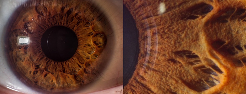 Macro photograph of an eye (left) and more detail (right)