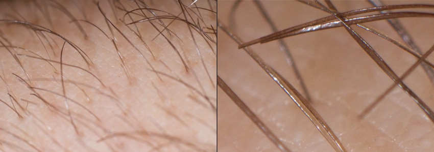 Macro photograph of arm hair (left) and more detail (right)